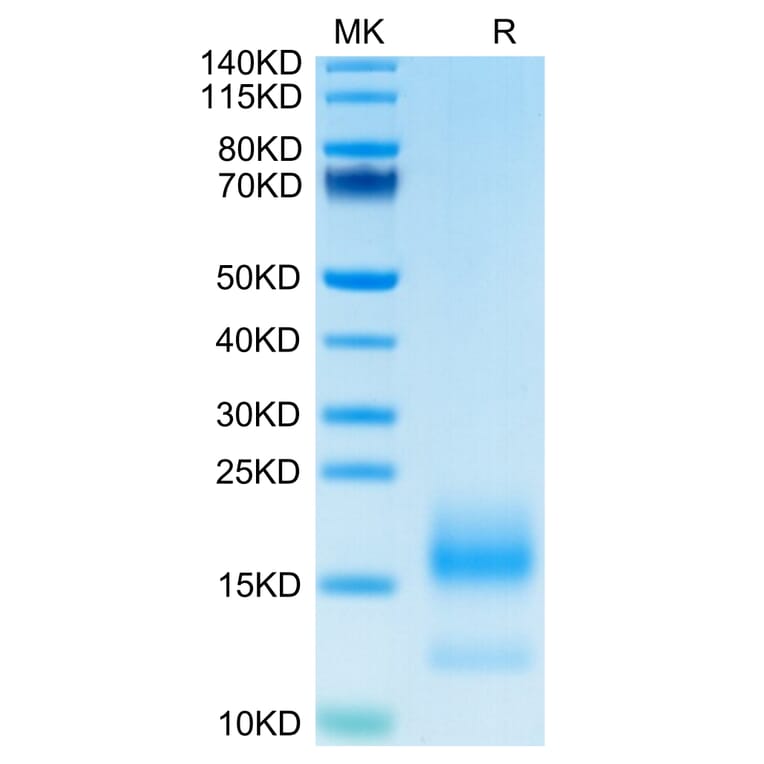 Tris-Bis PAGE - Recombinant Human BCMA Protein (C-terminal His and Avi Tag) (A330152) - Antibodies.com