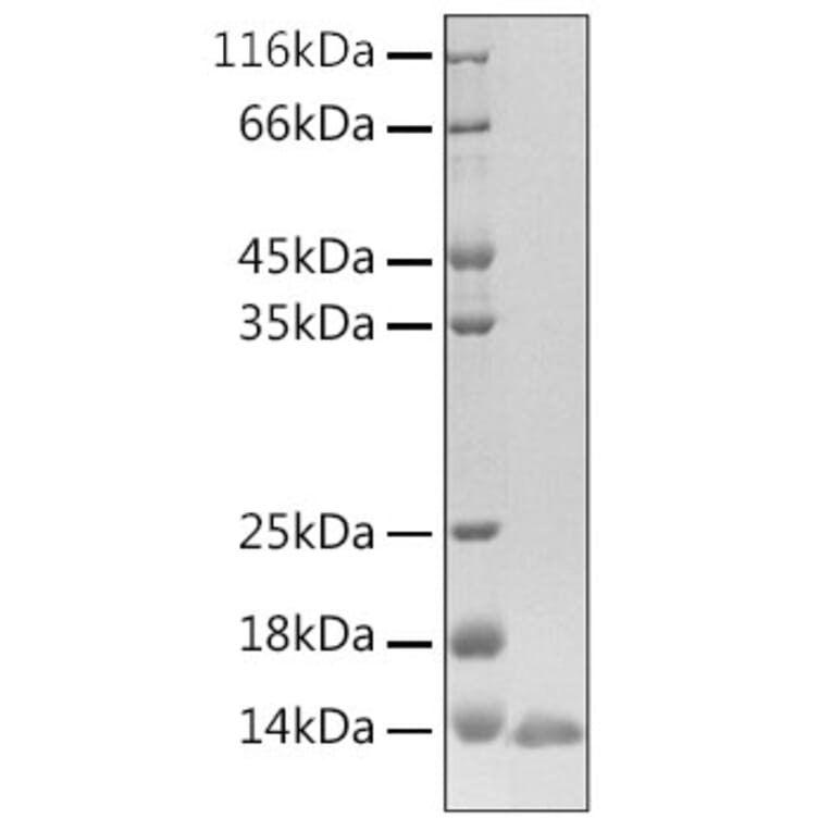SDS-PAGE - Recombinant Human BD-3 Protein (N-terminal His Tag) (A330153) - Antibodies.com