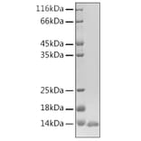SDS-PAGE - Recombinant Human BD-3 Protein (N-terminal His Tag) (A330153) - Antibodies.com