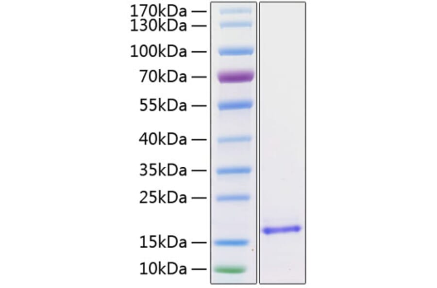SDS-PAGE - Recombinant Human BDNF Protein (C-terminal His Tag) (A330154) - Antibodies.com