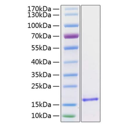 SDS-PAGE - Recombinant Human BDNF Protein (C-terminal His Tag) (A330154) - Antibodies.com