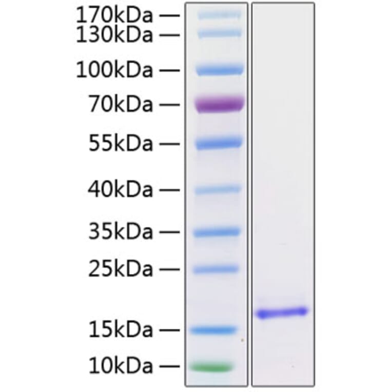 SDS-PAGE - Recombinant Human BDNF Protein (C-terminal His Tag) (A330154) - Antibodies.com
