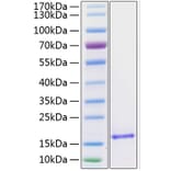 SDS-PAGE - Recombinant Human BDNF Protein (C-terminal His Tag) (A330154) - Antibodies.com