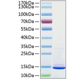 SDS-PAGE - Recombinant Human beta 2 Microglobulin Protein (C-terminal His Tag) (A330155) - Antibodies.com