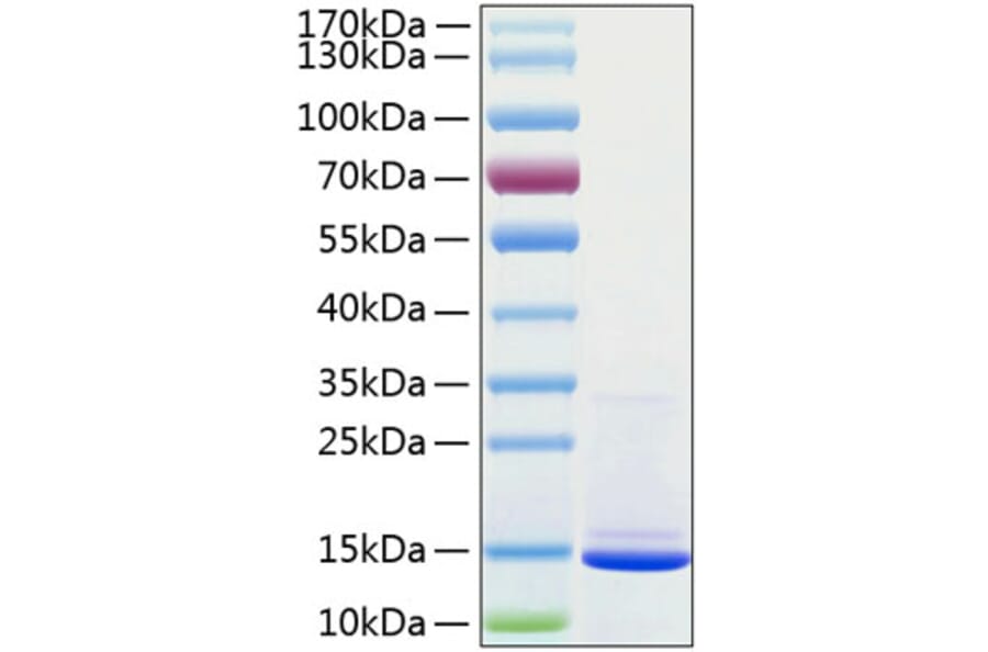 SDS-PAGE - Recombinant Human beta 2 Microglobulin Protein (C-terminal His Tag) (A330155) - Antibodies.com