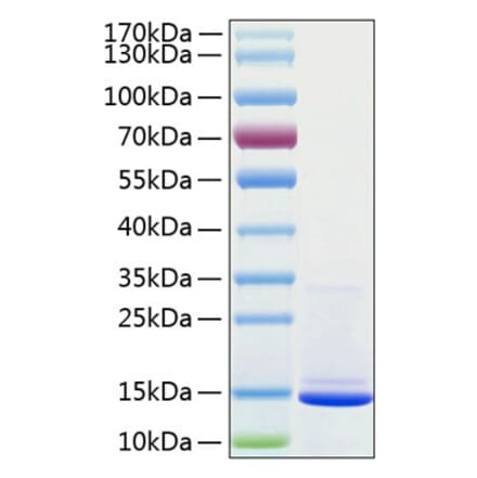 SDS-PAGE - Recombinant Human beta 2 Microglobulin Protein (C-terminal His Tag) (A330155) - Antibodies.com