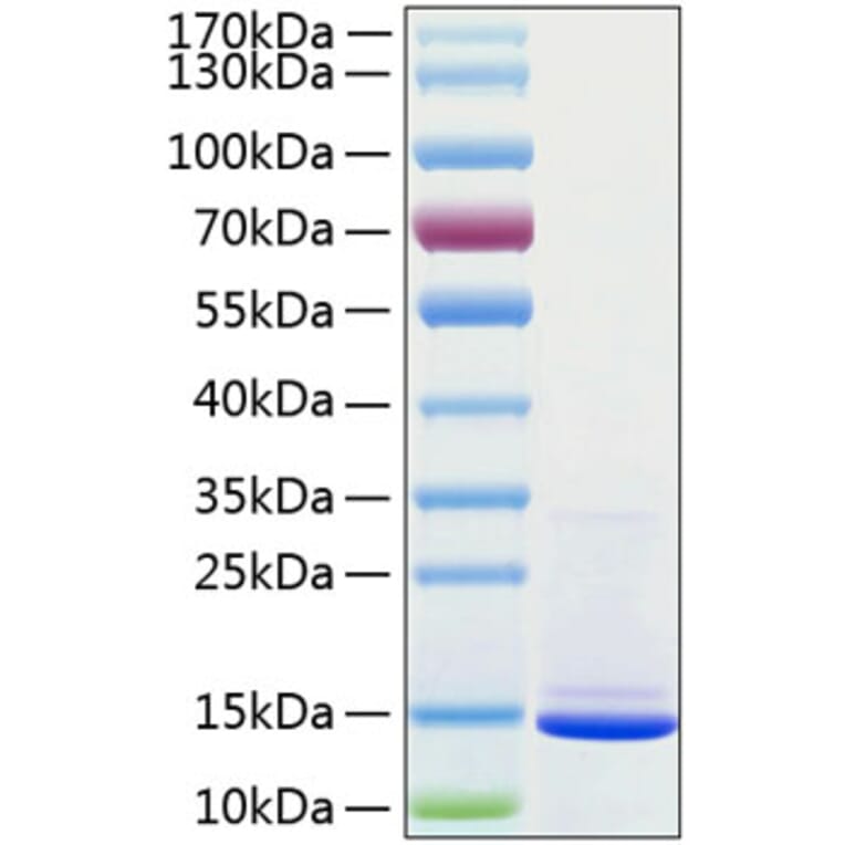 SDS-PAGE - Recombinant Human beta 2 Microglobulin Protein (C-terminal His Tag) (A330155) - Antibodies.com