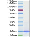 SDS-PAGE - Recombinant Human beta 2 Microglobulin Protein (C-terminal His Tag) (A330155) - Antibodies.com