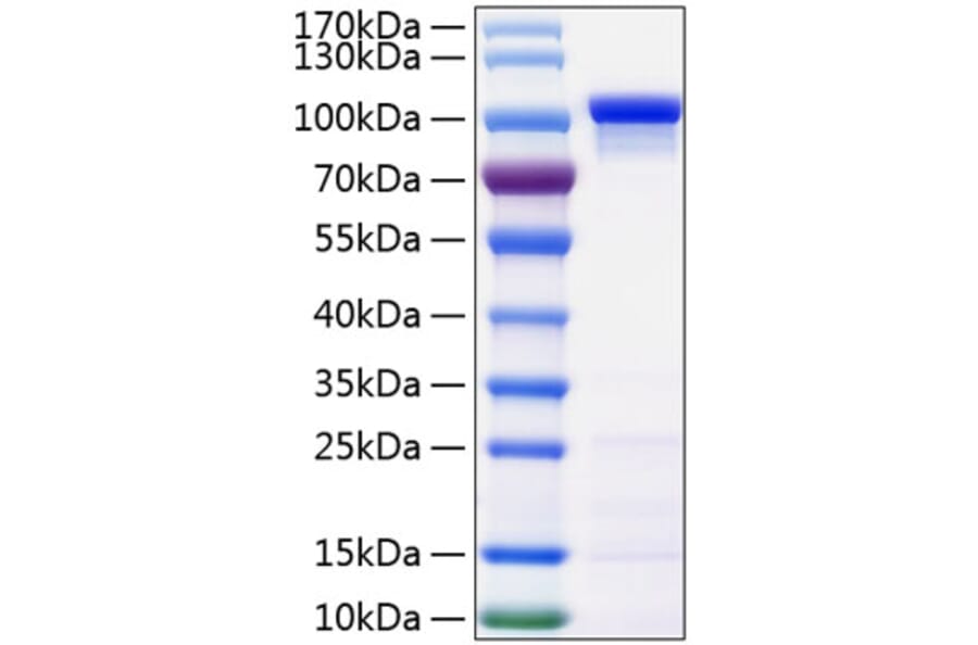 SDS-PAGE - Recombinant Human beta Catenin Protein (C-terminal His Tag) (A330156) - Antibodies.com