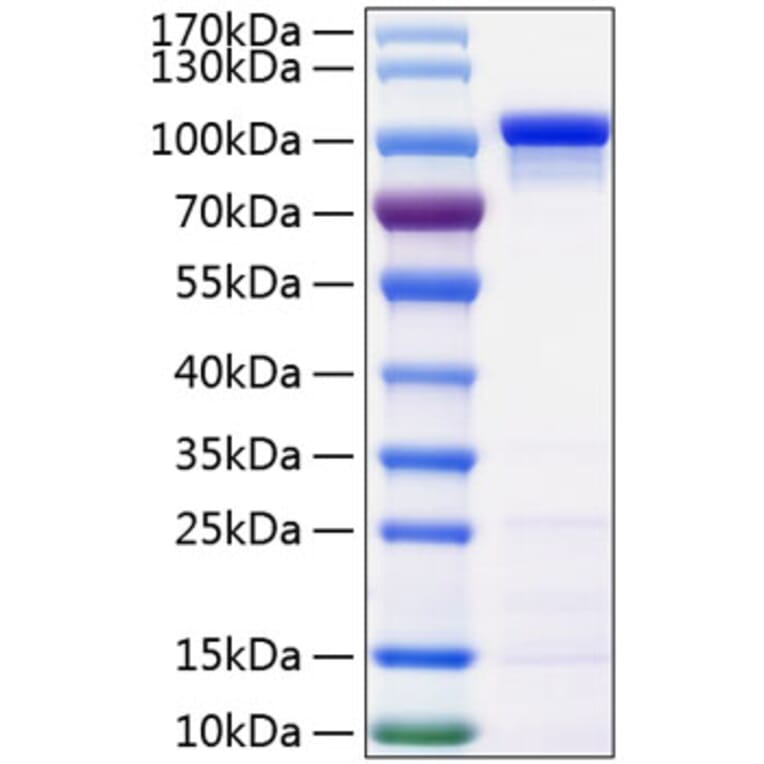 SDS-PAGE - Recombinant Human beta Catenin Protein (C-terminal His Tag) (A330156) - Antibodies.com