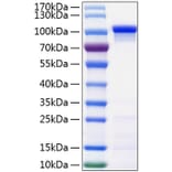 SDS-PAGE - Recombinant Human beta Catenin Protein (C-terminal His Tag) (A330156) - Antibodies.com