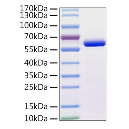 SDS-PAGE - Recombinant Human beta IV Tubulin Protein (N-terminal His Tag) (A330157) - Antibodies.com