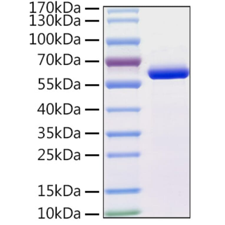 SDS-PAGE - Recombinant Human beta IV Tubulin Protein (N-terminal His Tag) (A330157) - Antibodies.com