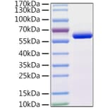 SDS-PAGE - Recombinant Human beta IV Tubulin Protein (N-terminal His Tag) (A330157) - Antibodies.com