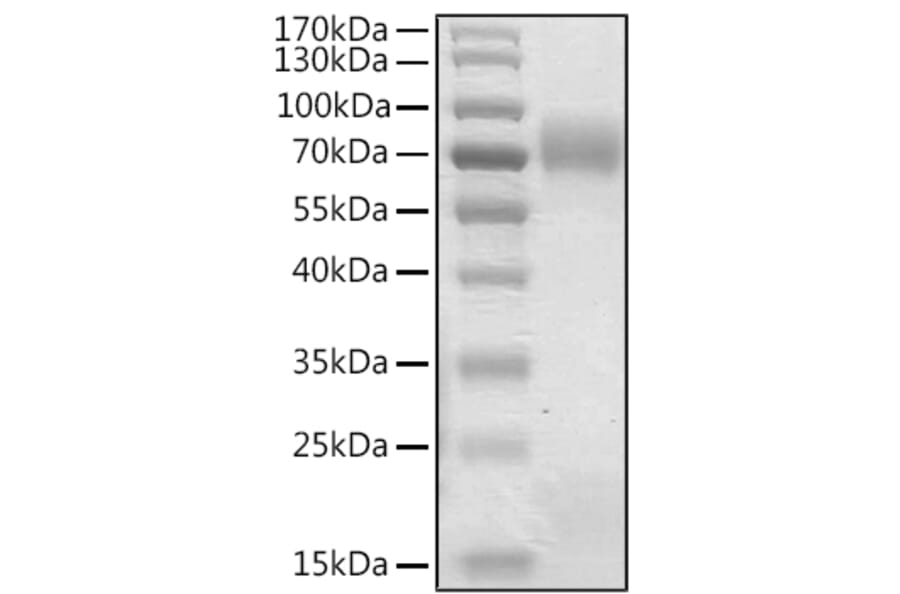 SDS-PAGE - Recombinant Human Betatrophin Protein (N-terminal Human Fc Tag) (A330158) - Antibodies.com