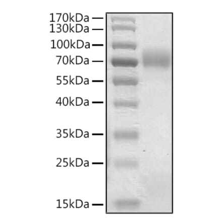 SDS-PAGE - Recombinant Human Betatrophin Protein (N-terminal Human Fc Tag) (A330158) - Antibodies.com