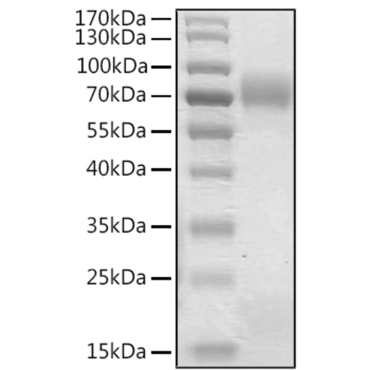 SDS-PAGE - Recombinant Human Betatrophin Protein (N-terminal Human Fc Tag) (A330158) - Antibodies.com