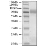 SDS-PAGE - Recombinant Human Betatrophin Protein (N-terminal Human Fc Tag) (A330158) - Antibodies.com