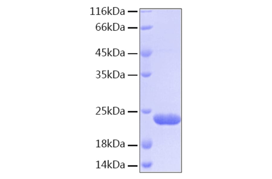 SDS-PAGE - Recombinant Human BID Protein (C-terminal His Tag) (A330159) - Antibodies.com
