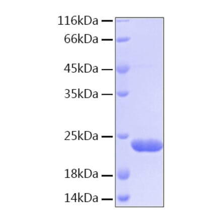 SDS-PAGE - Recombinant Human BID Protein (C-terminal His Tag) (A330159) - Antibodies.com
