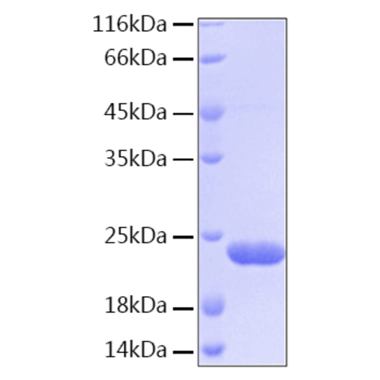 SDS-PAGE - Recombinant Human BID Protein (C-terminal His Tag) (A330159) - Antibodies.com