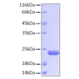 SDS-PAGE - Recombinant Human BID Protein (C-terminal His Tag) (A330159) - Antibodies.com