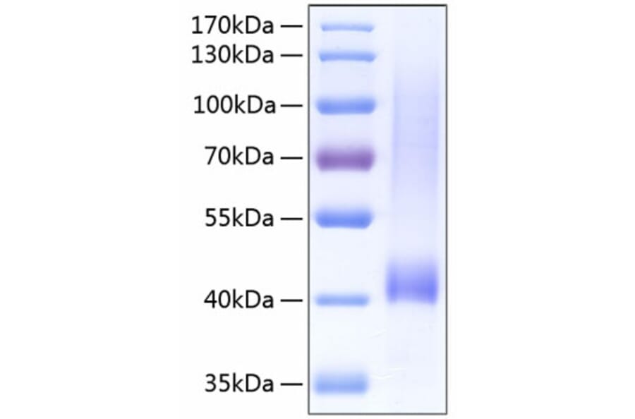 SDS-PAGE - Recombinant Human Biglycan Protein (C-terminal His Tag) (A330160) - Antibodies.com