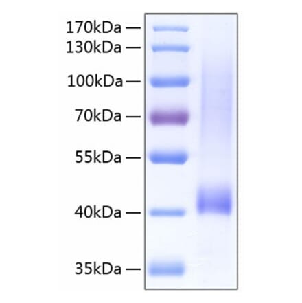 SDS-PAGE - Recombinant Human Biglycan Protein (C-terminal His Tag) (A330160) - Antibodies.com