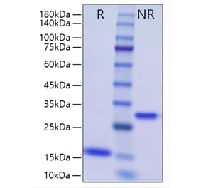 SDS-PAGE - Recombinant Human BMP2 Protein (A330161) - Antibodies.com