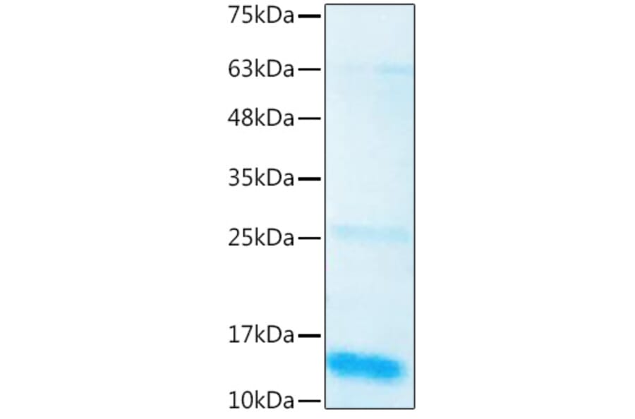 SDS-PAGE - Recombinant Human BMP3 Protein (C-terminal His Tag) (A330162) - Antibodies.com