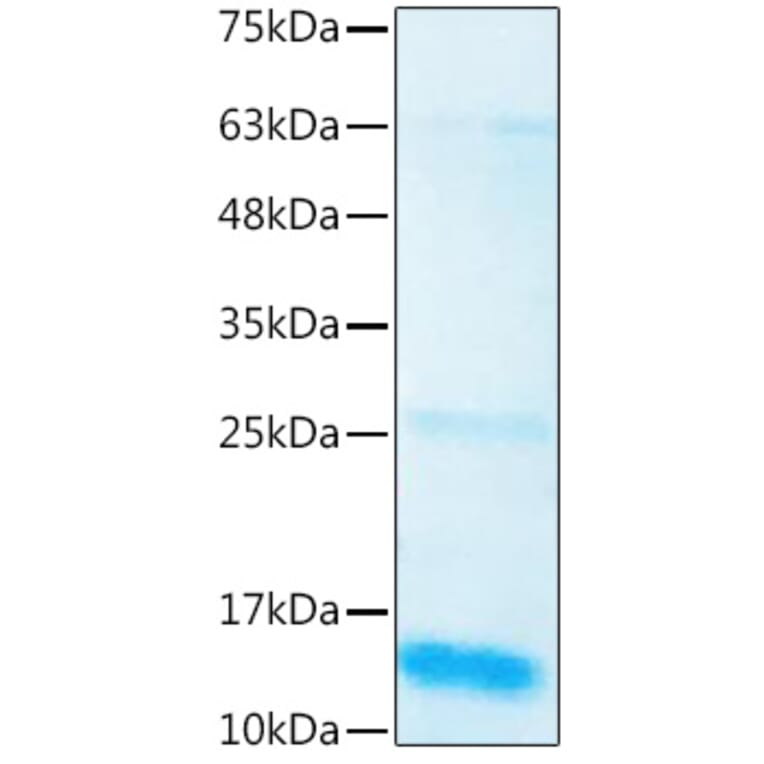 SDS-PAGE - Recombinant Human BMP3 Protein (C-terminal His Tag) (A330162) - Antibodies.com