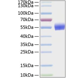 SDS-PAGE - Recombinant Human BMPR1A Protein (C-terminal Human Fc and His Tag) (A330163) - Antibodies.com