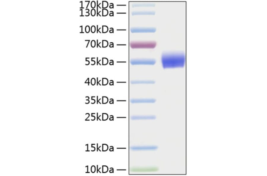 SDS-PAGE - Recombinant Human BMPR1A Protein (C-terminal Human Fc and His Tag) (A330163) - Antibodies.com