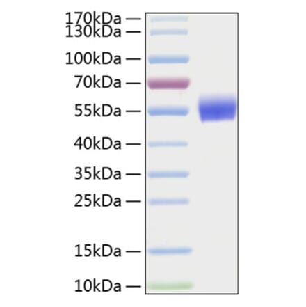 SDS-PAGE - Recombinant Human BMPR1A Protein (C-terminal Human Fc and His Tag) (A330163) - Antibodies.com