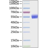 SDS-PAGE - Recombinant Human BMPR1A Protein (C-terminal Human Fc and His Tag) (A330163) - Antibodies.com