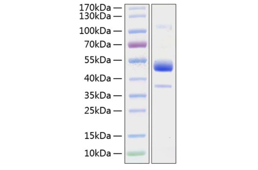 SDS-PAGE - Recombinant Human BMPR1B Protein (C-terminal Human Fc and His Tag) (A330164) - Antibodies.com