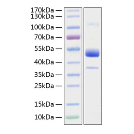 SDS-PAGE - Recombinant Human BMPR1B Protein (C-terminal Human Fc and His Tag) (A330164) - Antibodies.com