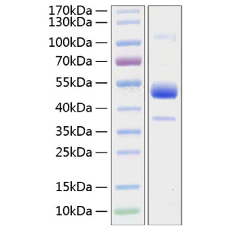SDS-PAGE - Recombinant Human BMPR1B Protein (C-terminal Human Fc and His Tag) (A330164) - Antibodies.com