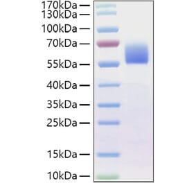 SDS-PAGE - Recombinant Human BMPR2 Protein (C-terminal Human Fc Tag) (A330165) - Antibodies.com
