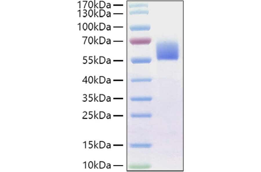 SDS-PAGE - Recombinant Human BMPR2 Protein (C-terminal Human Fc Tag) (A330165) - Antibodies.com