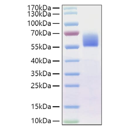 SDS-PAGE - Recombinant Human BMPR2 Protein (C-terminal Human Fc Tag) (A330165) - Antibodies.com