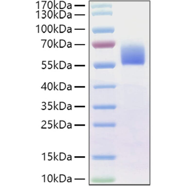 SDS-PAGE - Recombinant Human BMPR2 Protein (C-terminal Human Fc Tag) (A330165) - Antibodies.com