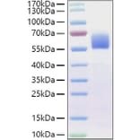 SDS-PAGE - Recombinant Human BMPR2 Protein (C-terminal Human Fc Tag) (A330165) - Antibodies.com