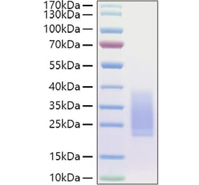 SDS-PAGE - Recombinant Human BMPR2 Protein (C-terminal His Tag) (A330166) - Antibodies.com