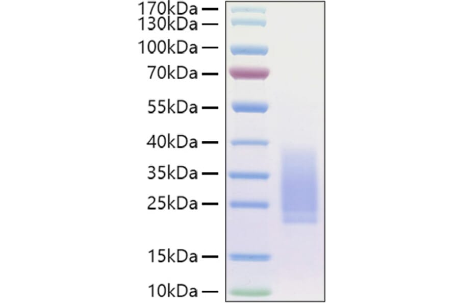 SDS-PAGE - Recombinant Human BMPR2 Protein (C-terminal His Tag) (A330166) - Antibodies.com