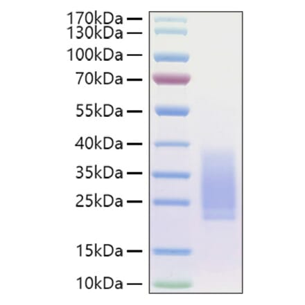 SDS-PAGE - Recombinant Human BMPR2 Protein (C-terminal His Tag) (A330166) - Antibodies.com