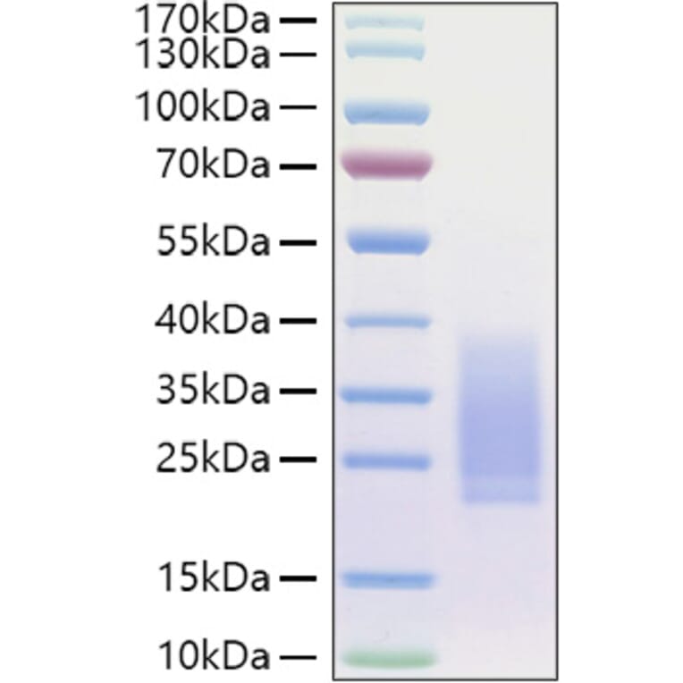 SDS-PAGE - Recombinant Human BMPR2 Protein (C-terminal His Tag) (A330166) - Antibodies.com