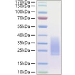 SDS-PAGE - Recombinant Human BMPR2 Protein (C-terminal His Tag) (A330166) - Antibodies.com