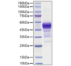 SDS-PAGE - Recombinant Human BTC Protein (C-terminal Human Fc Tag) (A330167) - Antibodies.com