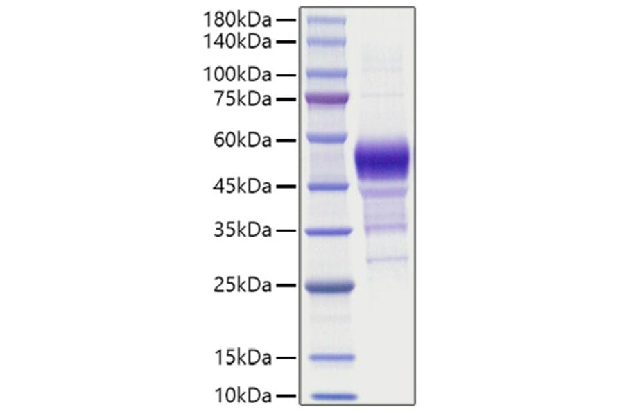 SDS-PAGE - Recombinant Human BTC Protein (C-terminal Human Fc Tag) (A330167) - Antibodies.com